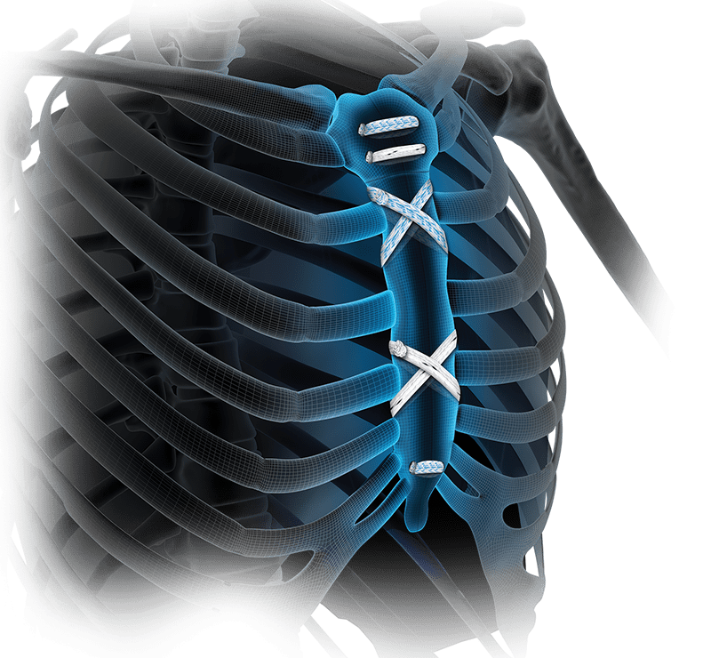 Cardiothoracic